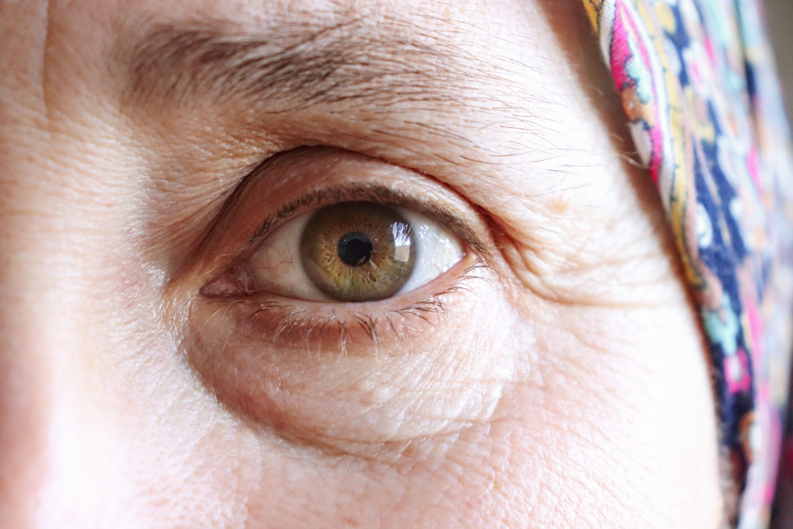 Detailed close-up of an elderly woman's eye wearing a colorful headscarf.